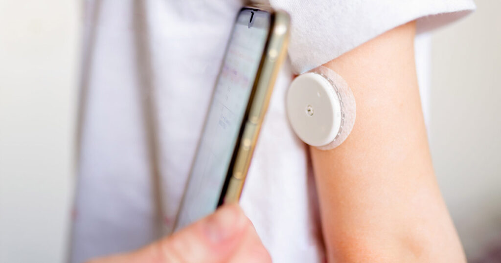 Person checking glucose levels on a smartphone linked to a wearable monitor.